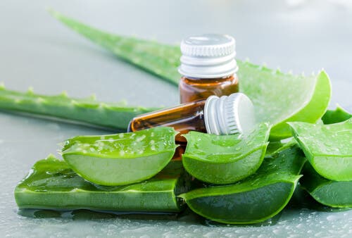 Cómo utilizar gel de aloe vera y caléndula para tratar las quemaduras