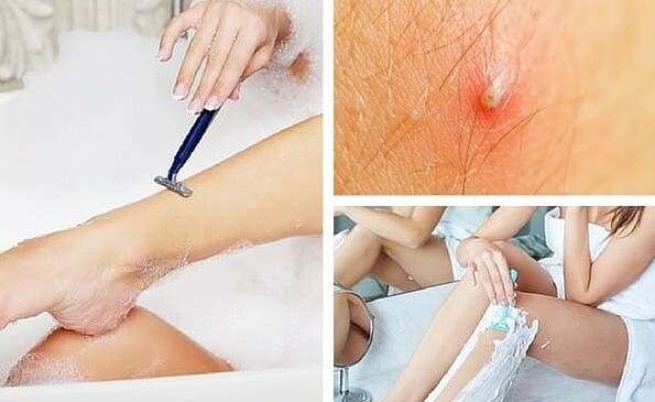 Aprende a preparar una crema de afeitar natural y evita vellos encarnados