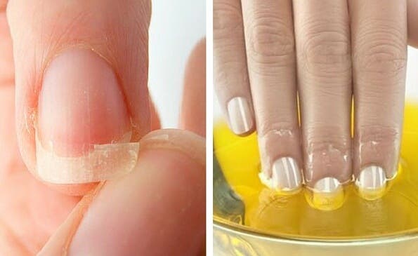 Cómo cuidar las uñas para fortalecerlas