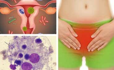 6 consejos para aliviar una infección vaginal por hongos