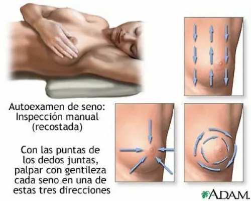 Autoexamen de mama tumbada