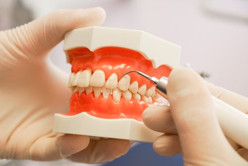Periodontitis: todo lo que debes saber