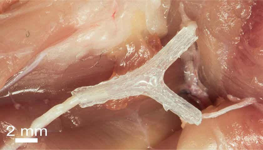 Una pequeña impresión 3D podría ayudar a restaurar los nervios lesionados