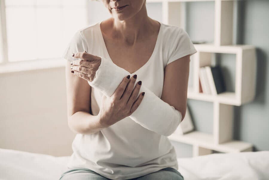 Mujer usando un yeso en el brazo