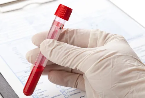 contra celulas de leucemia