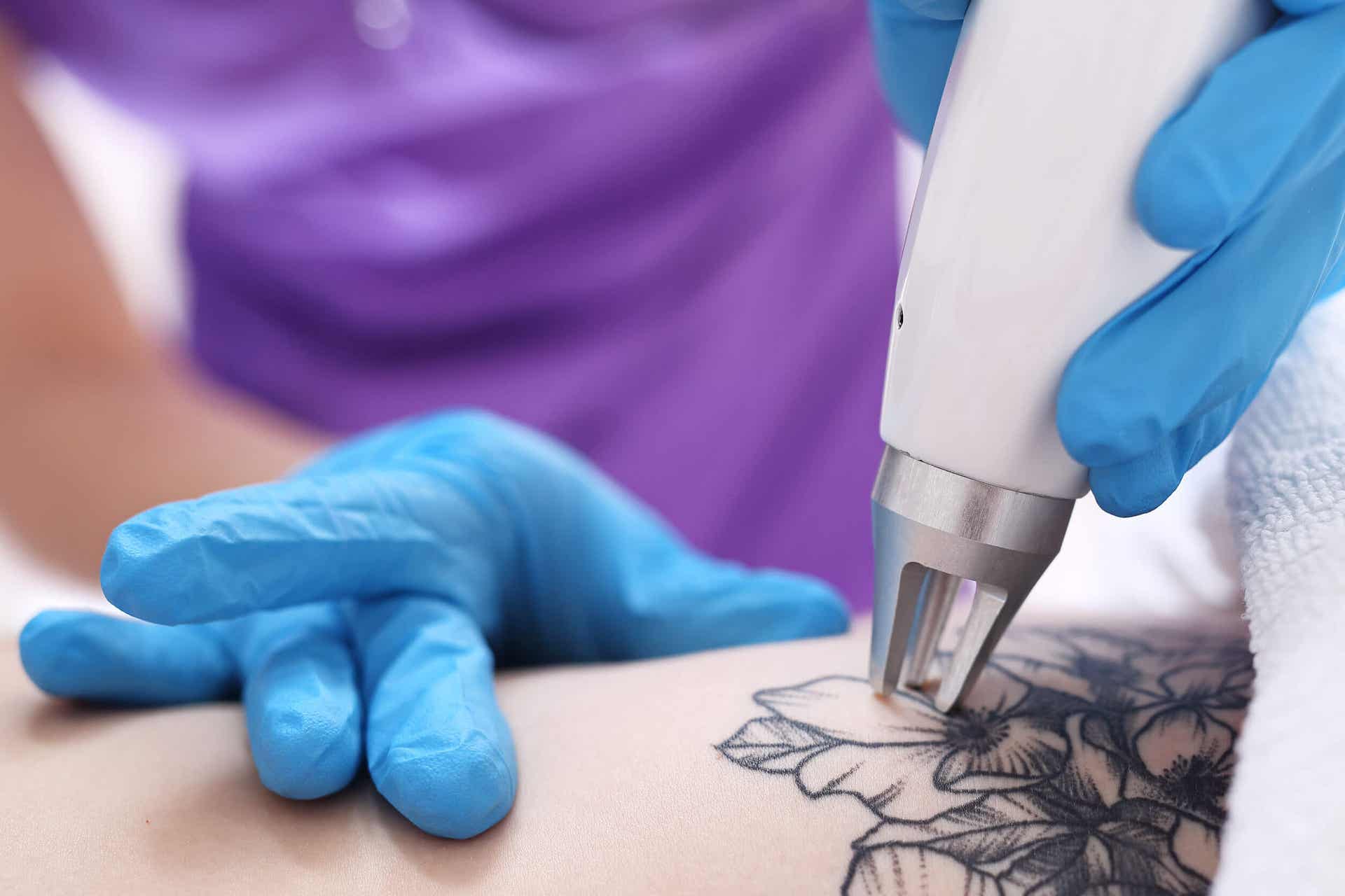 Tatuajes para “borrar” las heridas de la vida