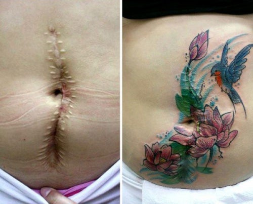 Tatuajes para "borrar" las heridas de la vida