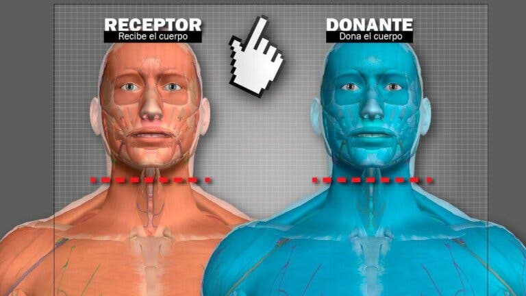Trasplante de cabeza: un hombre ruso se ofrece voluntario para ser el primero en la historia