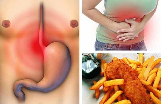 Alimentos prohibidos para las úlceras estomacales