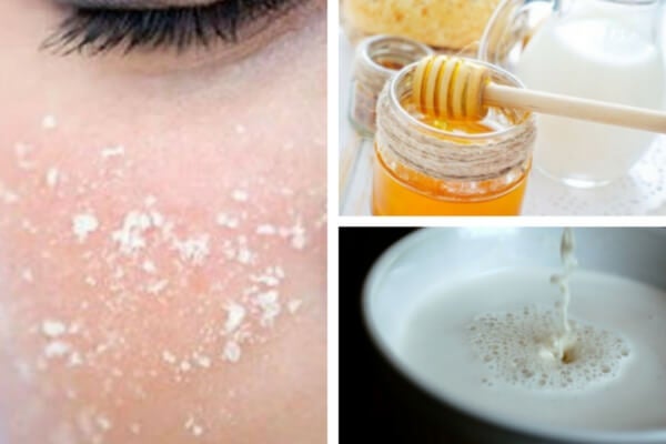 5 tratamientos a base de leche para una piel suave y hermosa