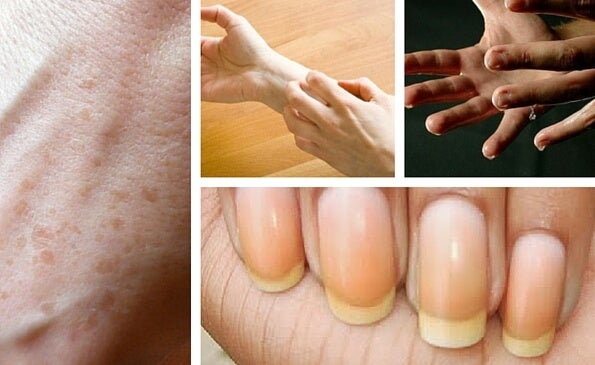 9 interesantes cosas que las manos reflejan sobre tu salud