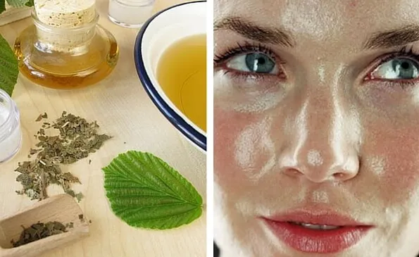 5 Mascarillas para un cutis graso