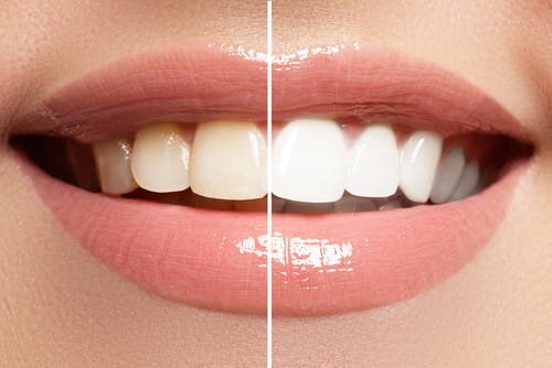 Un maquillaje correcto nos ayuda a lucir una sonrisa envidiable.