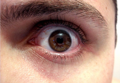 ¿Cómo afecta a tu cuerpo y rostro no dormir bien?