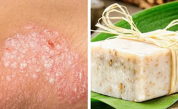Receta de jabón casero para pieles con eccema