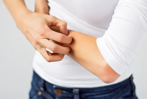 alergia de la piel