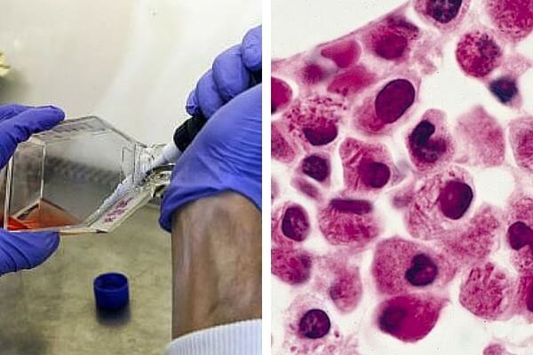 Un grupo de científicos encuentra un sistema para que las células de leucemia se destruyan entre sí