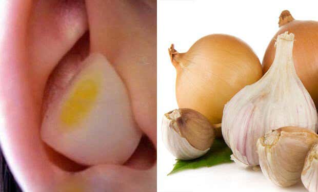 ¿Por qué es beneficioso ponerse un trozo de ajo o cebolla en la oreja?