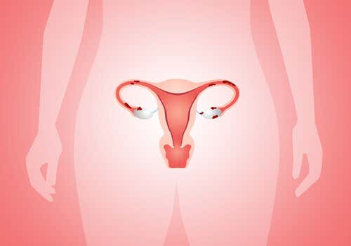 utero-con-endometrosis