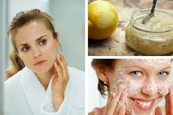 6 recomendaciones que te ayudarán a disminuir las manchas faciales
