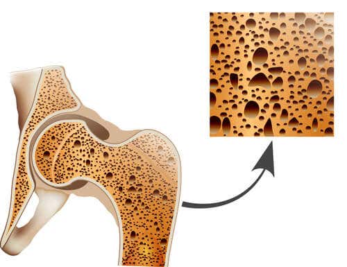 Prendre soin des os et prévenir l'ostéoporose.