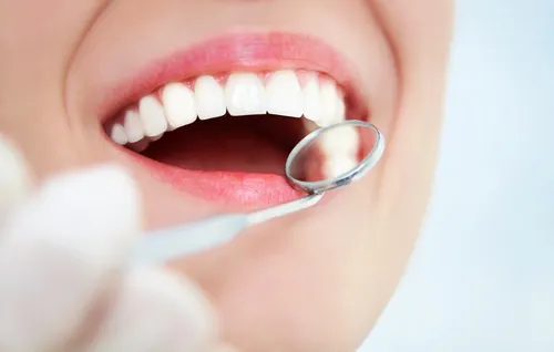 Problemas de dientes