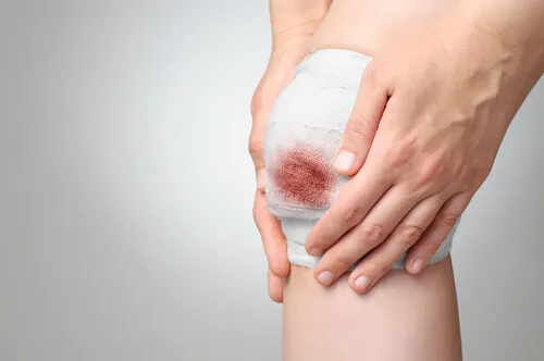 Bandage om sår på knæ til at forebygge, at et sår bliver betændt