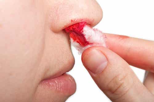 Taponar la nariz cuando sangra