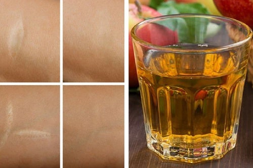 Tónico antioxidante para las arrugas, quemaduras del sol y cicatrices