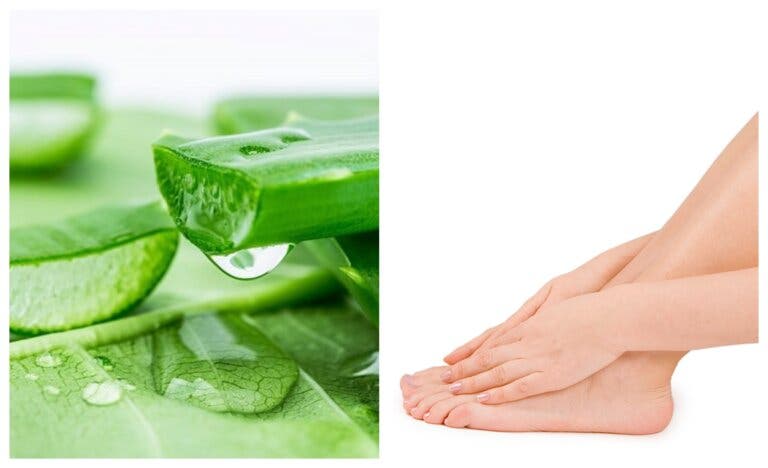 Cómo combatir los hongos en los pies con aloe vera