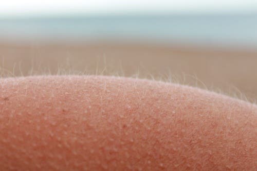 los pelos se nos ponen de punta