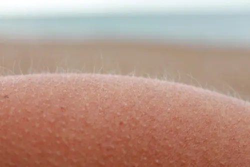 los pelos se nos ponen de punta