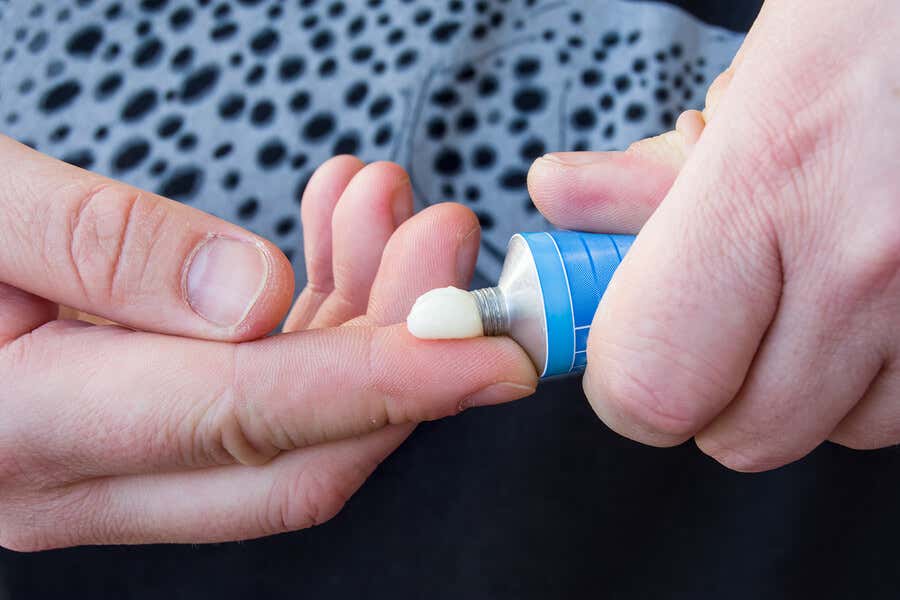 Persona aplicándose crema medicinal en la mano.