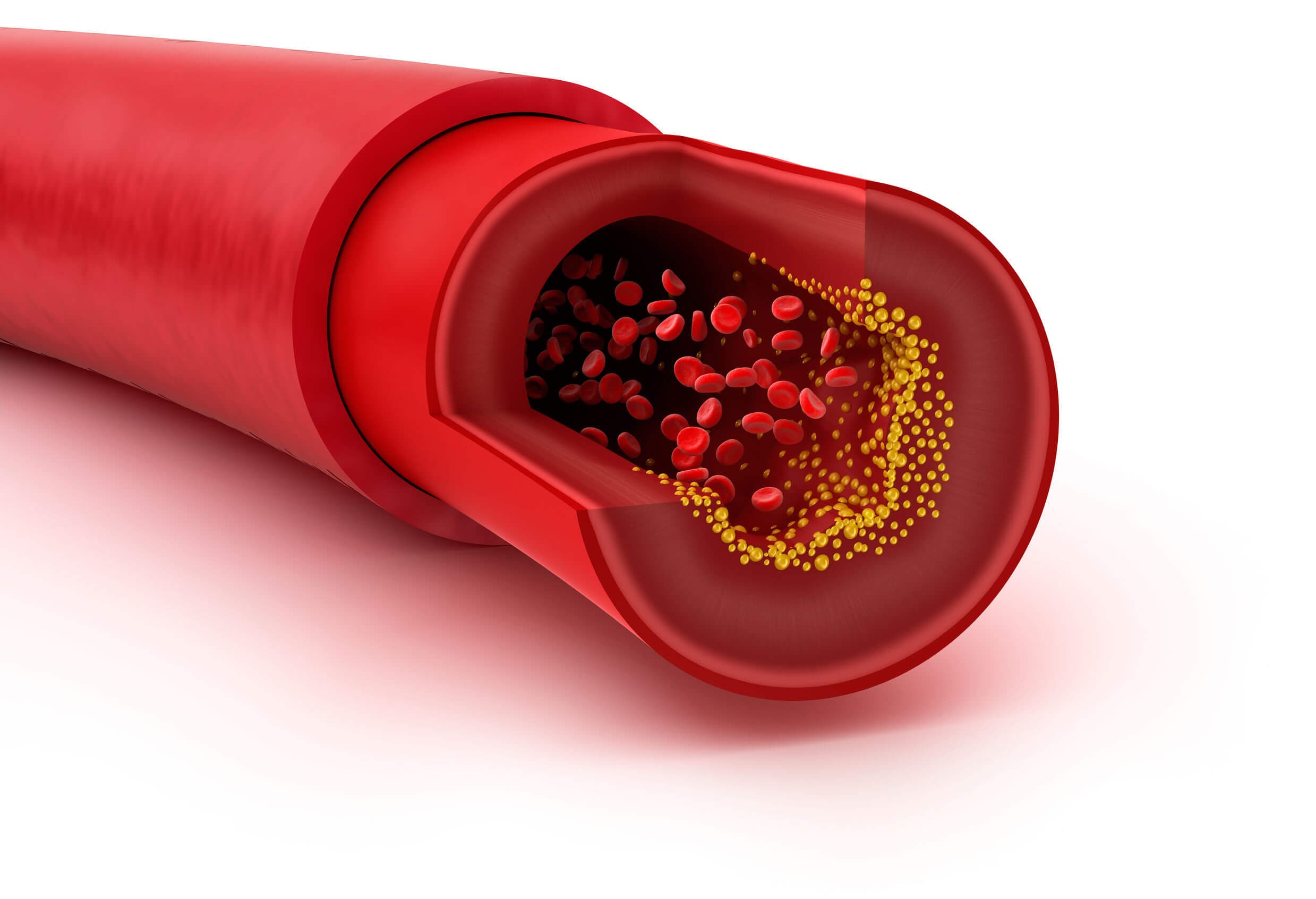 Comer salmón puede prevenir enfermedades cardiovasculares.