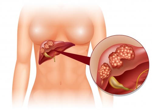 Desintoxican el hígado