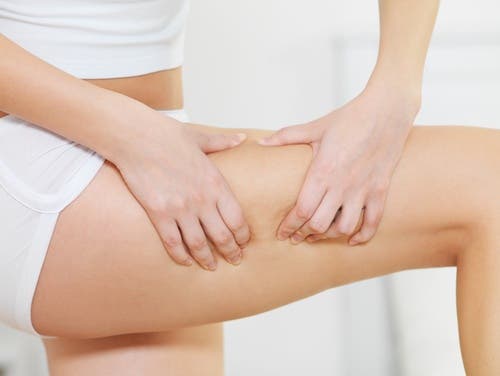Combatir la celulitis