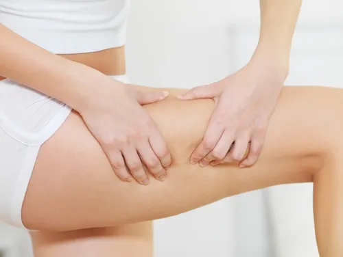 Combatir la celulitis