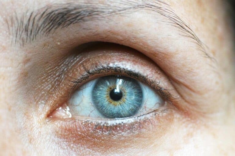 ¿Por qué tenemos derrames oculares?