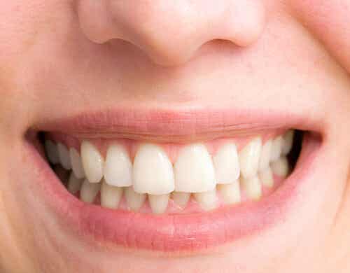 8 factores que vuelven los dientes amarillos