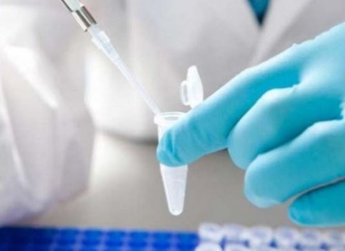 Una biopsia líquida permitirá detectar tumores cerebrales