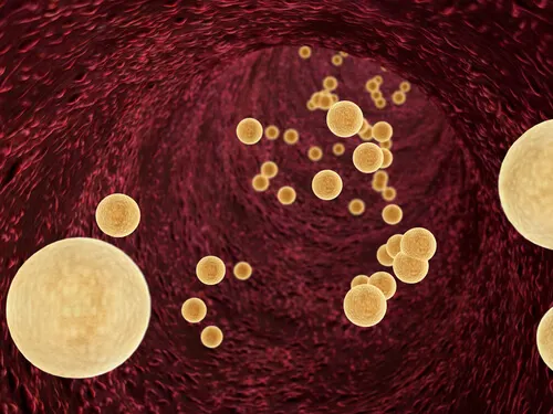 Los mejores remedios naturales para reducir los triglicéridos