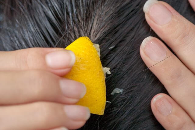 ¿Cómo combatir la caída del cabello con jugo de limón?