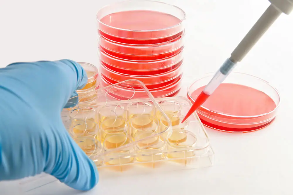 Test de ureasa con rojo de fenol.