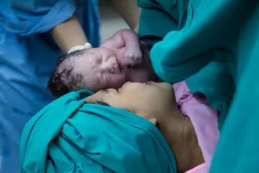 Bebés nacidos por cesárea reciben un “baño” de bacterias vaginales
