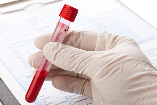 ¿Por qué son especiales las personas con sangre 0?
