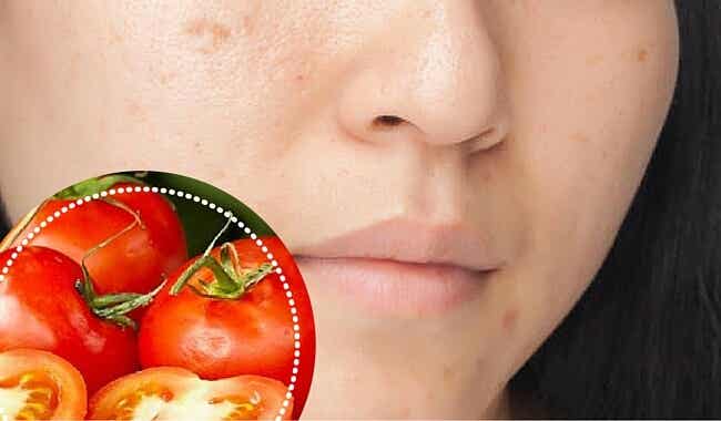 6 ingredientes naturales para atenuar las manchas en el rostro