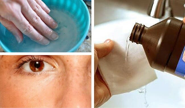 7 increíbles usos del agua oxigenada que seguro no conoces