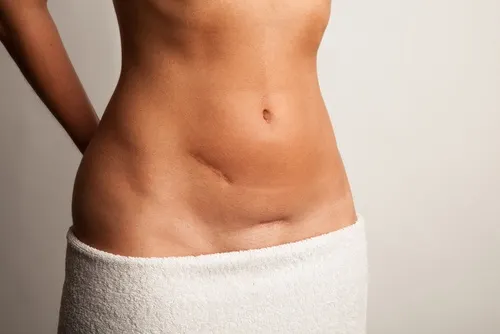 Crema contra las cicatrices