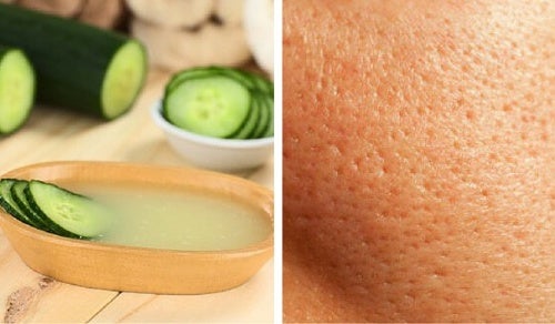 Cómo preparar una mascarilla casera para cerrar los poros con ingredientes naturales