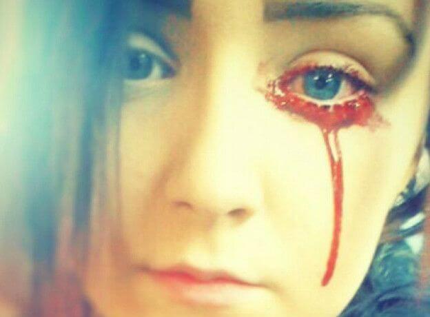 Una joven sangra por los ojos y los oídos y nadie sabe por qué